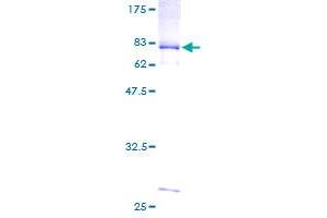 Image no. 1 for Sialophorin (SPN) (AA 1-400) protein (GST tag) (ABIN1321208)
