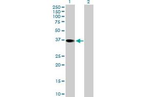 Western Blot analysis of RBKS expression in transfected 293T cell line by RBKS MaxPab polyclonal antibody. (Ribokinase anticorps  (AA 1-322))
