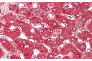 Detection of CP in Human Liver Tissue using Polyclonal Antibody to Ceruloplasmin (CP)