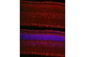 Immunofluorescence analysis of rat retina cells using RPGR Rabbit pAb (ABIN3015609, ABIN3015610, ABIN3015611, ABIN1682567 and ABIN6218971) at dilution of 1:50 (40x lens). (RPGR anticorps  (AA 1-260))