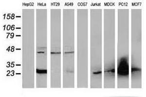 Image no. 4 for anti-Four and A Half LIM Domains 1 (FHL1) antibody (ABIN1500975)
