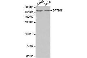 Western Blotting (WB) image for anti-Spectrin Beta, Non-Erythrocytic 1 (SPTBN1) antibody (ABIN1874930) (SPTBN1 anticorps)