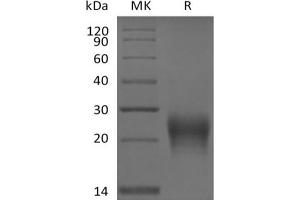 Western Blotting (WB) image for Fas Ligand (TNF Superfamily, Member 6) (FASL) protein (His tag) (ABIN7319799)