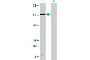 Western Blot analysis of MAGOH expression in transfected 293T cell line by MAGOH monoclonal antibody (M02), clone 4H8. (MAGOH anticorps  (AA 1-110))