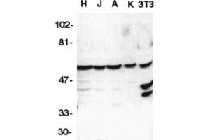 Image no. 1 for anti-Caspase 10, Apoptosis-Related Cysteine Peptidase (CASP10) (AA 505-521) antibody (ABIN201420) (Caspase 10 anticorps  (AA 505-521))