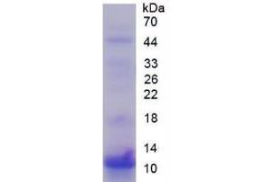 Image no. 1 for S100 Calcium Binding Protein P (S100P) (AA 1-95) protein (His tag) (ABIN1080775)