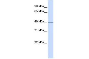 ACADS antibody used at 1 ug/ml to detect target protein.