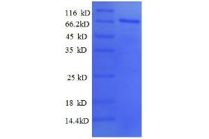 SDS-PAGE (SDS) image for Paired Box Gene 2a (PAX2A) (AA 1-363), (partial) protein (GST tag) (ABIN1047491)