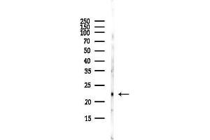 Western blot analysis of lysates from HUVEC cells(starvation,24h treatment), using Claudin 1 Antibody at 1/1000 dilution.
