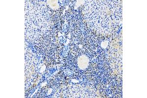 Immunohistochemistry of paraffin-embedded rat ovary using MYOG antibody (ABIN5974015) at dilution of 1/100 (20x lens). (Myogenin anticorps)