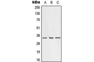 Western blot analysis of CD32c expression in HeLa (A), Raw264. (FCGR2C anticorps  (C-Term))