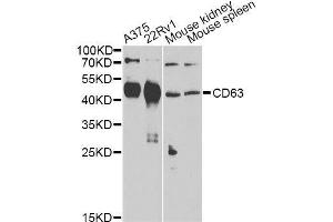 Western blot analysis of extracts of various cell lines, using CD63 Antibody. (CD63 anticorps)