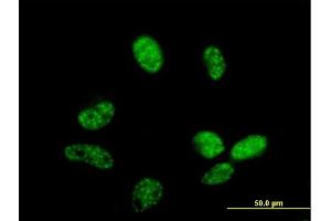 Immunofluorescence of purified MaxPab antibody to ZC3H14 on HeLa cell. (ZC3H14 anticorps  (AA 1-306))