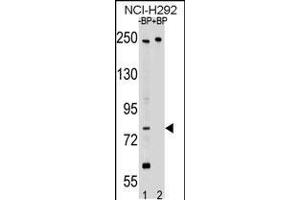 Western blot analysis of APPL2 Antibody Pab pre-incubated without(lane 1) and with(lane 2) blocking peptide in NCI-H292 cell line lysate. (APPL2 anticorps  (N-Term))