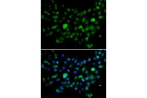 Immunofluorescence analysis of A549 cell using MCM10 antibody. (MCM10 anticorps)