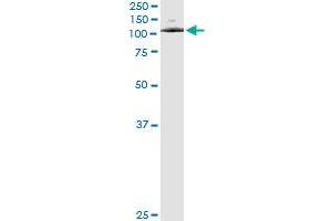 Immunoprecipitation of ATP2C1 transfected lysate using anti-ATP2C1 monoclonal antibody and Protein A Magnetic Bead , and immunoblotted with ATP2C1 MaxPab rabbit polyclonal antibody.