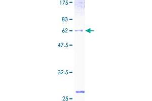 UDP-Galactose-4-Epimerase (GALE) (AA 1-348) protein (GST tag)