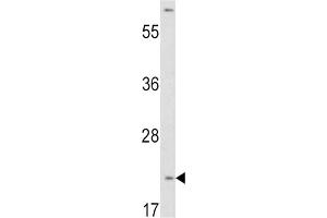 Western Blotting (WB) image for anti-Von Hippel-Lindau Tumor Suppressor, E3 Ubiquitin Protein Ligase (VHL) antibody (ABIN2905637)