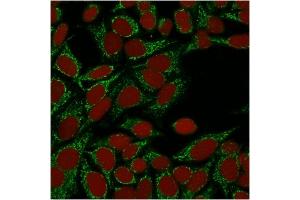 Confocal immunofluorescence image of HeLa cells using Galectin-1 Monospecific Mouse Monoclonal Antibody (GAL1/1831). (LGALS1/Galectin 1 anticorps  (AA 12-108))