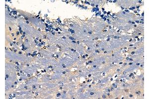 ABIN6261819 and ABIN6278083 at 1/100 staining Mouse brain tissue by IHC-P. (Fascin anticorps  (C-Term))