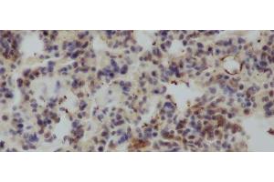 Immunohistochemistry of paraffin-embedded Rat lung using IL4 Polyclonal Antibody at dilution of 1:50 (IL-4 anticorps)