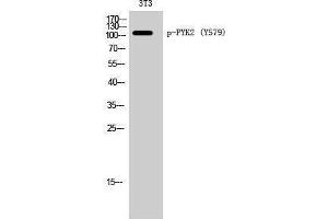 Western Blotting (WB) image for anti-PTK2B Protein tyrosine Kinase 2 beta (PTK2B) (pTyr579) antibody (ABIN3179709) (PTK2B anticorps  (pTyr579))