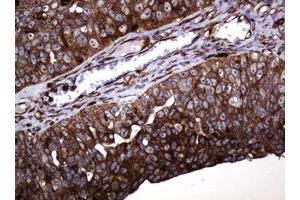 Image no. 18 for anti-Pogo Transposable Element with KRAB Domain (POGK) antibody (ABIN1500329)