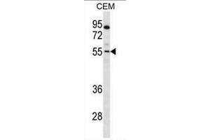 PAX7 Antibody (Center) western blot analysis in CEM cell line lysates (35µg/lane). (PAX7 anticorps  (Middle Region))