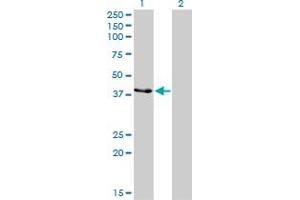Western Blot analysis of CKMT1B expression in transfected 293T cell line by CKMT1B monoclonal antibody (M04), clone 2C8.