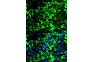 Immunofluorescence analysis of HeLa cell using TPM1 antibody. (Tropomyosin anticorps  (AA 1-245))
