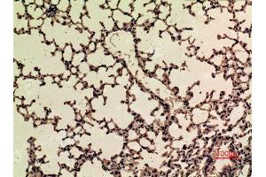Immunohistochemistry (IHC) analysis of paraffin-embedded Mouse Lung, antibody was diluted at 1:100.
