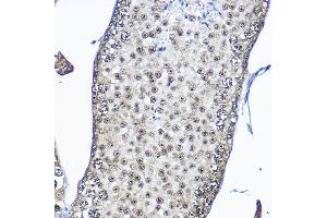 Immunohistochemistry of paraffin-embedded mouse testis using Casein Kinase 2 beta (Casein Kinase 2 beta (CSNK2B)) Rabbit pAb  at dilution of 1:100 (40x lens).