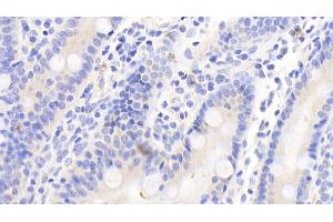 Detection of MMP10 in Human Small intestine Tissue using Polyclonal Antibody to Matrix Metalloproteinase 10 (MMP10)