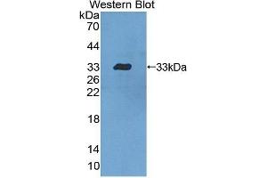 Western Blotting (WB) image for anti-Signal Transducer and Activator of Transcription 5B (STAT5B) (AA 497-749) antibody (ABIN3206169) (STAT5B anticorps  (AA 497-749))