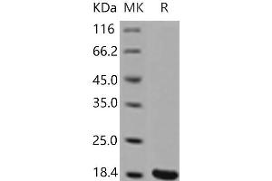 Western Blotting (WB) image for Interleukin 1, beta (IL1B) (Active) protein (ABIN7321252) (IL-1 beta Protéine)