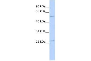 WB Suggested Anti-TFDP1 Antibody Titration:  0. (DP1 anticorps  (Middle Region))