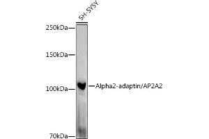 Western blot analysis of extracts of SH-SY5Y cells, using Alph-adaptin/ antibody (ABIN6130980, ABIN6136955, ABIN6136957 and ABIN6221039) at 1:1000 dilution. (AP2A2 anticorps  (AA 590-939))