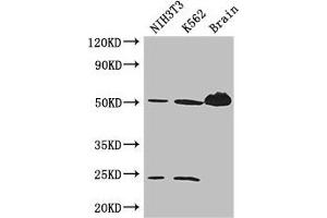Western Blot Positive WB detected in: NIH/3T3 whole cell lysate, K562 whole cell lysate, Mouse brain tissue All lanes: TUBA4A antibody at 3 μg/mL Secondary Goat polyclonal to rabbit IgG at 1/50000 dilution Predicted band size: 50, 49 kDa Observed band size: 50, 24 kDa (TUBA4A anticorps  (AA 20-183))