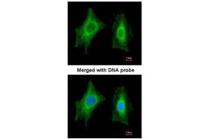 ICC/IF Image Immunofluorescence analysis of paraformaldehyde-fixed HeLa, using PSPH, antibody at 1:200 dilution.