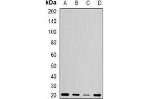 Western blot analysis of Centrin-1 expression in Jurkat (A), Hela (B), mouse testis (C), rat testis (D) whole cell lysates. (Centrin 1 anticorps)