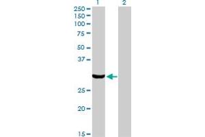 Western Blot analysis of PRKRA expression in transfected 293T cell line by PRKRA monoclonal antibody (M01), clone 1B9-1A7.