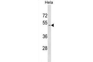 SD1 Antibody (N-term) (ABIN1881815 and ABIN2839003) western blot analysis in Hela cell line lysates (35 μg/lane).