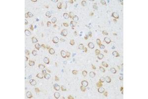 Immunohistochemistry of paraffin-embedded mouse brain using DHODH antibody.