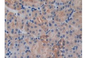 Detection of IL17RA in Mouse Kidney Tissue using Polyclonal Antibody to Interleukin 17 Receptor A (IL17RA) (IL17RA anticorps  (AA 590-848))