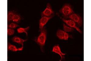 ABIN6272372 staining HeLa by IF/ICC. (OR4N4 anticorps)