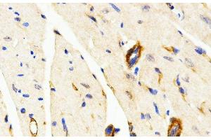 Immunohistochemistry of paraffin-embedded Mouse heart using LAMP3 Polyclonal Antibody at dilution of 1:200 (40x lens). (LAMP3 anticorps)