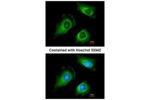 ICC/IF Image Immunofluorescence analysis of methanol-fixed HeLa, using Fukutin, antibody at 1:200 dilution.