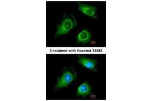 ICC/IF Image Immunofluorescence analysis of methanol-fixed HeLa, using Fukutin, antibody at 1:200 dilution. (Fukutin anticorps)