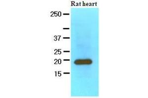 The extracts of Rat heart (60 ug) were resolved by SDS-PAGE, transferred to nitrocellulose membrane and probed with anti-human MYL2 (1:1000). (MYL2 anticorps  (AA 1-166))