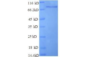 SDS-PAGE (SDS) image for Dipeptidyl-Peptidase 6 (DPP6) (AA 111-859), (Extracellular) protein (His tag) (ABIN5713406)